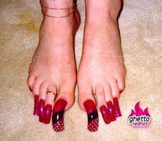 ugly feet pics|Ugly Feet Pics for Sale 